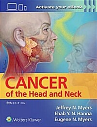 Cancer of the Head and Neck (Hardcover, 5)