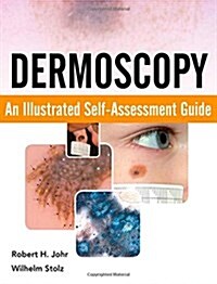 Dermoscopy (Paperback, 1st)