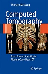 Computed Tomography: From Photon Statistics to Modern Cone-Beam CT (Paperback)
