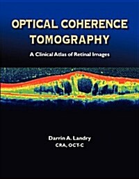 Optical Coherence Tomography a Clinical Atlas of Retinal Images (Paperback)