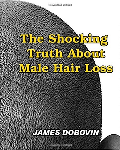 The Shocking Truth about Male Hair Loss: Secrets You Need to Know about Losing Hair So You Can Stop from Going Bald (Paperback)