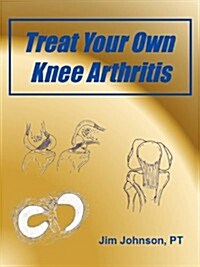 Treat Your Own Knee Arthritis (Paperback)
