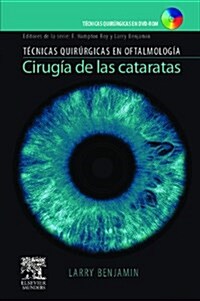 Cirugia de las Cataratas with DVD (Hardcover, DVD)