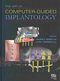 The Art of Computer-Guided Implantology (Hardcover, 1st)