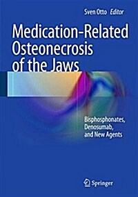 Medication-Related Osteonecrosis of the Jaws: Bisphosphonates, Denosumab, and New Agents (Hardcover, 2015)