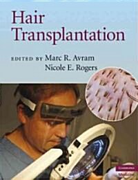Hair Transplantation (Hardcover)