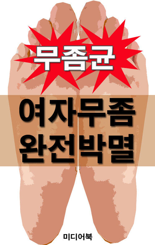 여자무좀 완전박멸