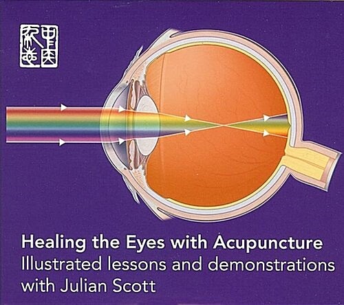 Healing the Eyes With Acupuncture (DVD, 1st)