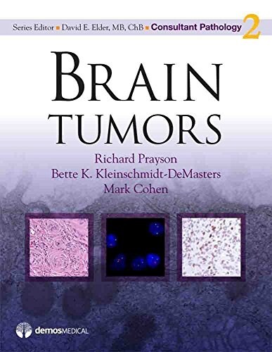 Brain Tumors (Hardcover)