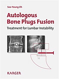 Autologous Bone Plugs Fusion (Hardcover, 1st)