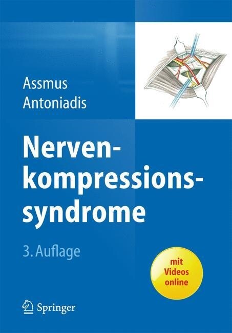 Nervenkompressionssyndrome (Hardcover, 3, 3. Aufl. 2015)