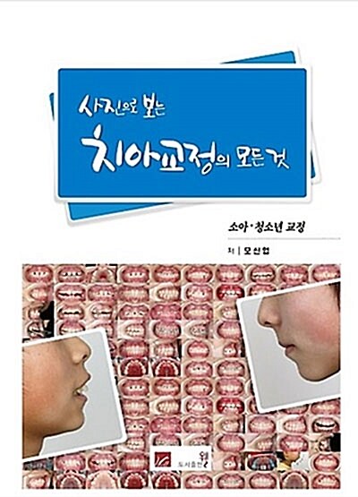 사진으로 보는 치아교정의 모든 것 : 소아.청소년 교정