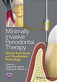 Minimally Invasive Periodontal Therapy: Clinical Techniques and Visualization Technology (Paperback)
