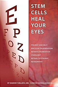 Stem Cells Heal Your Eyes: Prevent and Help: Macular Degeneration, Retinitis Pigmentosa, Stargardt, Retinal Distrophy, and Retinopathy. (Paperback)