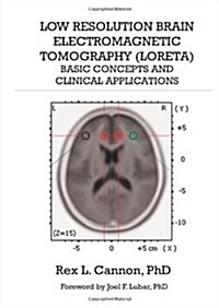 Low Resolution Brain Electromagnetic Tomography (Loreta): Basic Concepts and Clinical Applications (Paperback)