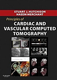 Principles of Cardiovascular Computed Tomography eBook: Expert Consult (Principles of Cardiovascular Imaging) (Printed Access Code, 1st)