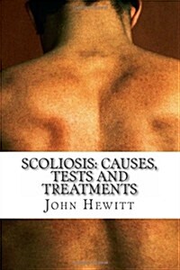 Scoliosis: Causes, Tests and Treatments (Paperback)