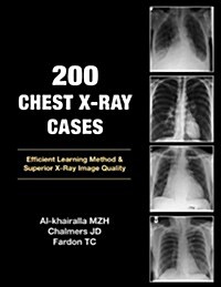 200 Chest X-Ray Cases (Paperback)