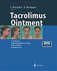 Tacrolimus Ointment: A Topical Immunomodulator for Atopic Dermatitis (Paperback, Softcover Repri)