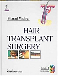 Hair Transplant Surgery (Hardcover, 1st, INA)