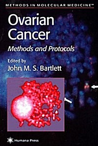 Ovarian Cancer: Methods and Protocols (Paperback, Softcover Repri)