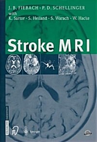 Stroke MRI (Paperback)