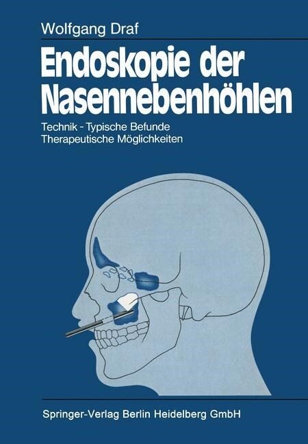 Endoskopie Der Nasennebenh?len: Technik - Typische Befunde, Therapeutische M?lichkeiten (Paperback, Softcover Repri)