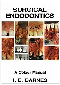 Surgical Endodontics: A Colour Manual (Paperback, 1984)