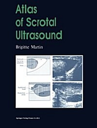 Atlas of Scrotal Ultrasound (Paperback, Softcover Repri)