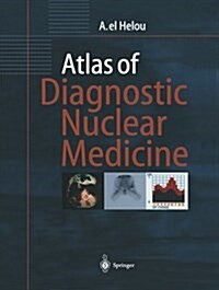 Atlas of Diagnostic Nuclear Medicine (Paperback, Softcover Repri)