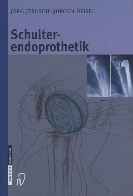 Schulterendoprothetik: Indikation, Implantate, Op-Technik, Nachbehandlung, Begutachtung (Paperback, Softcover Repri)