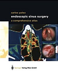 Endoscopic Sinus Surgery: A Comprehensive Atlas (Paperback, Softcover Repri)