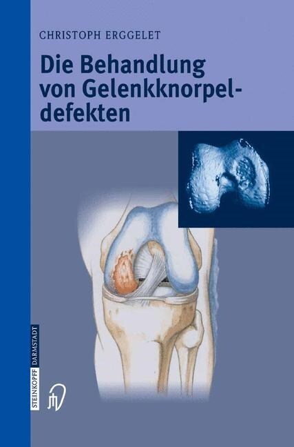 Die Behandlung Von Gelenkknorpeldefekten (Paperback, Softcover Repri)
