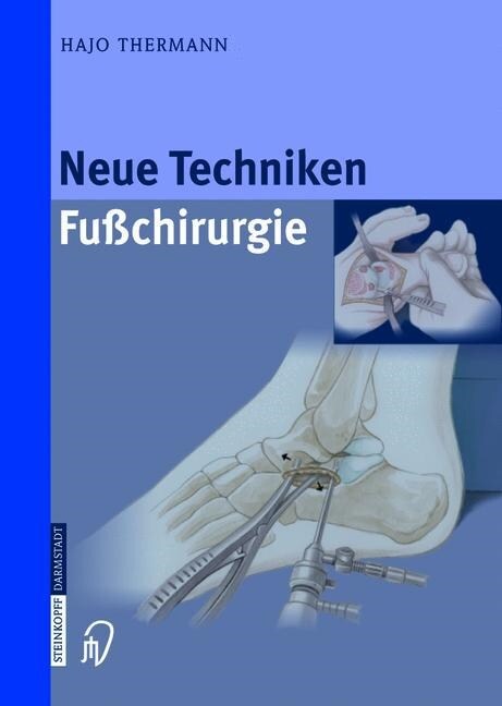 Neue Techniken Fusschirurgie (Paperback)
