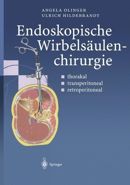 Endoskopische Wirbels?lenchirurgie: Thorakal - Transperitoneal - Retroperitoneal (Paperback, Softcover Repri)