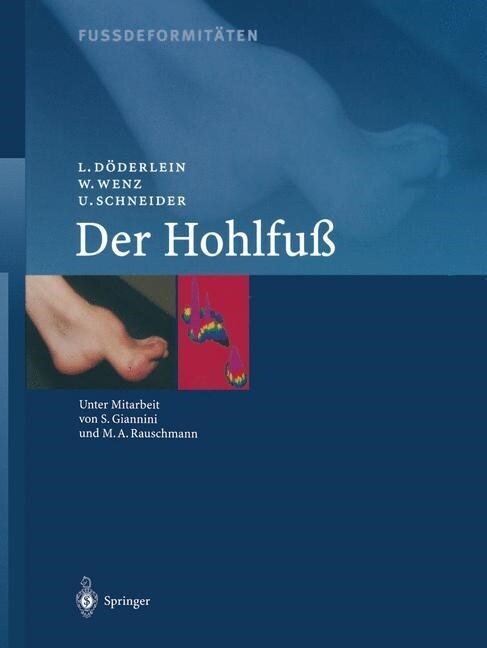 Fussdeformit?en: Der Hohlfuss (Paperback, Softcover Repri)
