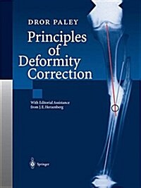 Principles of Deformity Correction (Paperback)