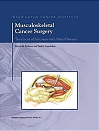 Musculoskeletal Cancer Surgery: Treatment of Sarcomas and Allied Diseases (Paperback, Softcover Repri)