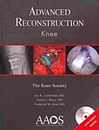 Advanced Reconstruction: Knee (Hardcover)