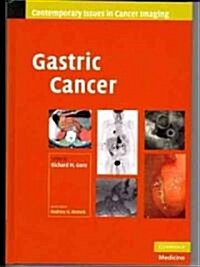 Gastric Cancer (Hardcover)