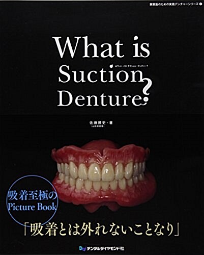 What is Suction Denture？ (開業醫のための實踐デンチャ-シリ-ズ 4) (大型本)