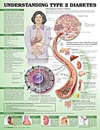 Understanding Type 2 Diabetes Anatomical Chart (Other, 3)