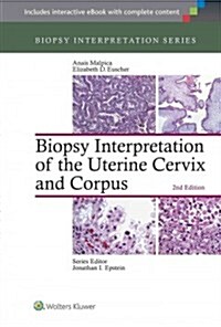 Biopsy Interpretation of the Uterine Cervix and Corpus (Hardcover, 2)