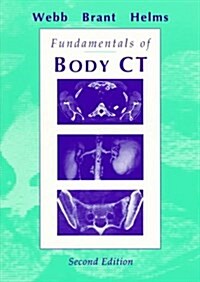 Fundamentals of Body CT, 2e (Fundamentals of Radiology) (Paperback, 2nd)