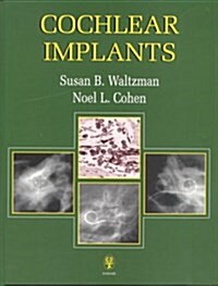 Cochlear Implants (Paperback, 1st)