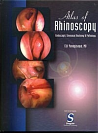 Atlas of Rhinoscopy (Paperback, 1st)