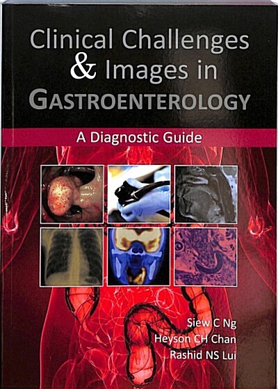 Clinical Challenges & Images in Gastroenterology : A Diagnostic Guide (Paperback)