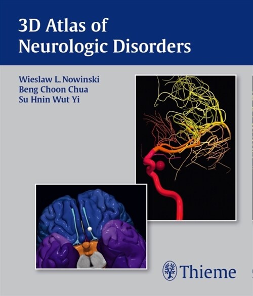 3D Atlas of Neurologic Disorders (Software)