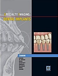 Specialty Imaging: Dental Implants (Hardcover)