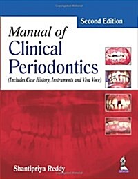 Manual of Clinical Periodontics (Paperback, 2)